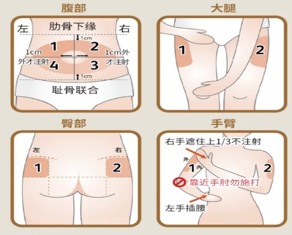 胰岛素的注射001.jpg